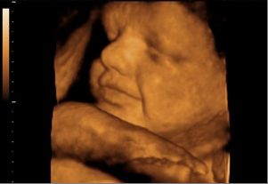 15 неделя беременности: ощущения, признаки, развитие плода